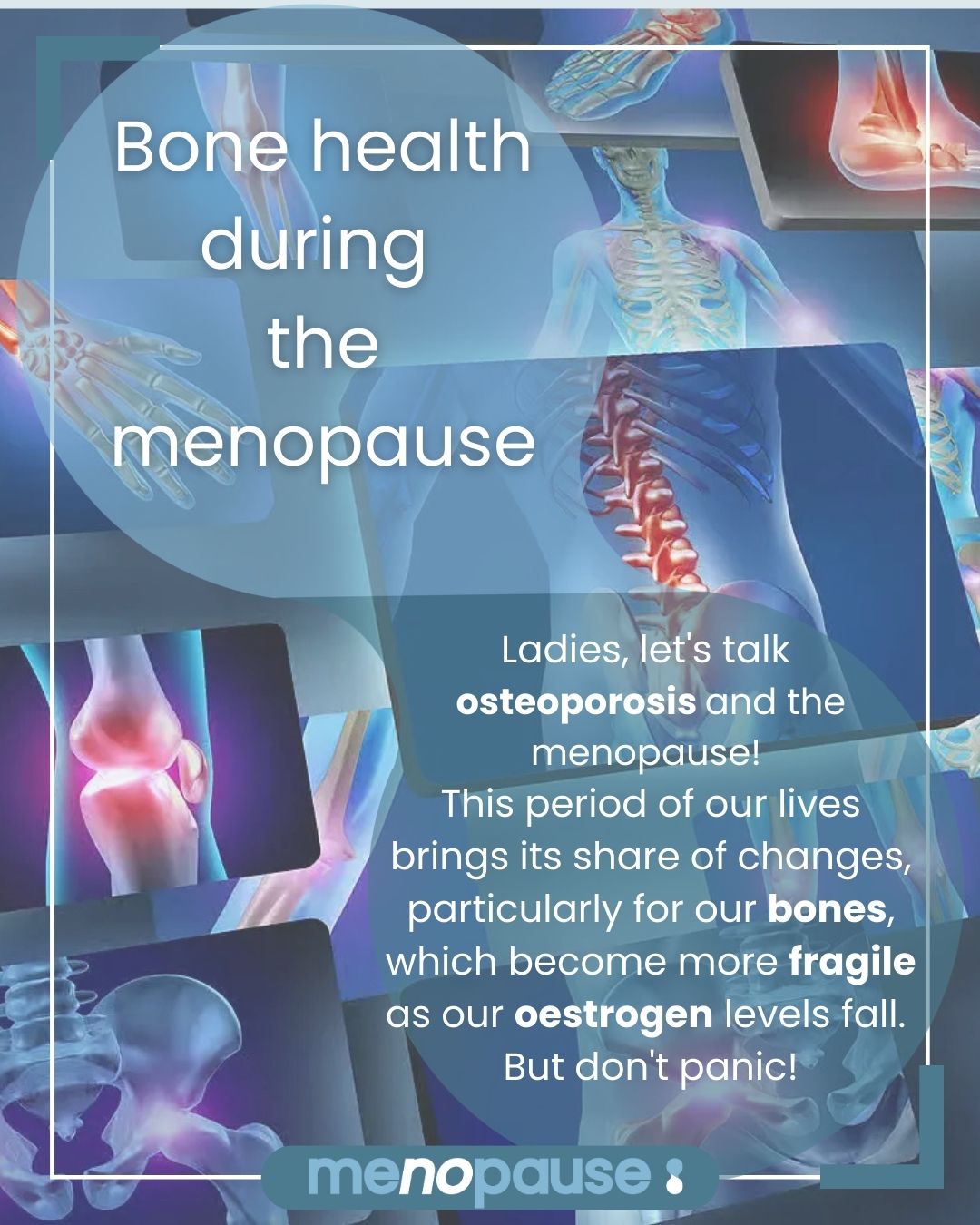 Bone health during the menopause